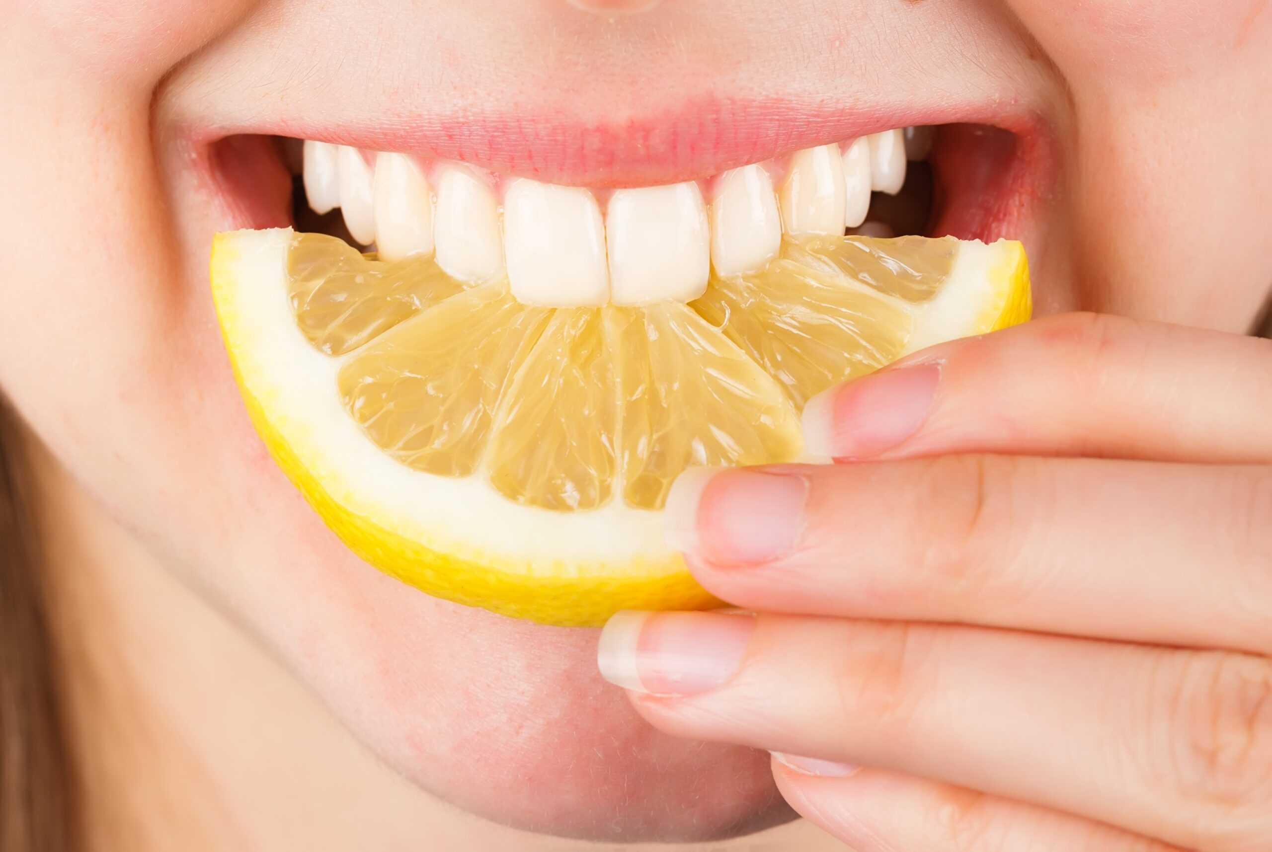 Erosión dental: cómo proteger tus dientes del desgaste ácido | Clínica Vivanta